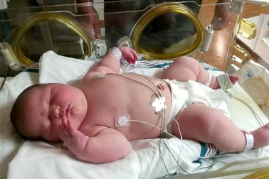 Bé sơ sinh khổng lồ ra đời ở Mỹ