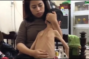 Não lòng người mẹ nghèo nhìn hai đứa con chết mòn.