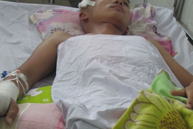 Nam sinh lớp 10 bị bạn đánh nứt hộp sọ