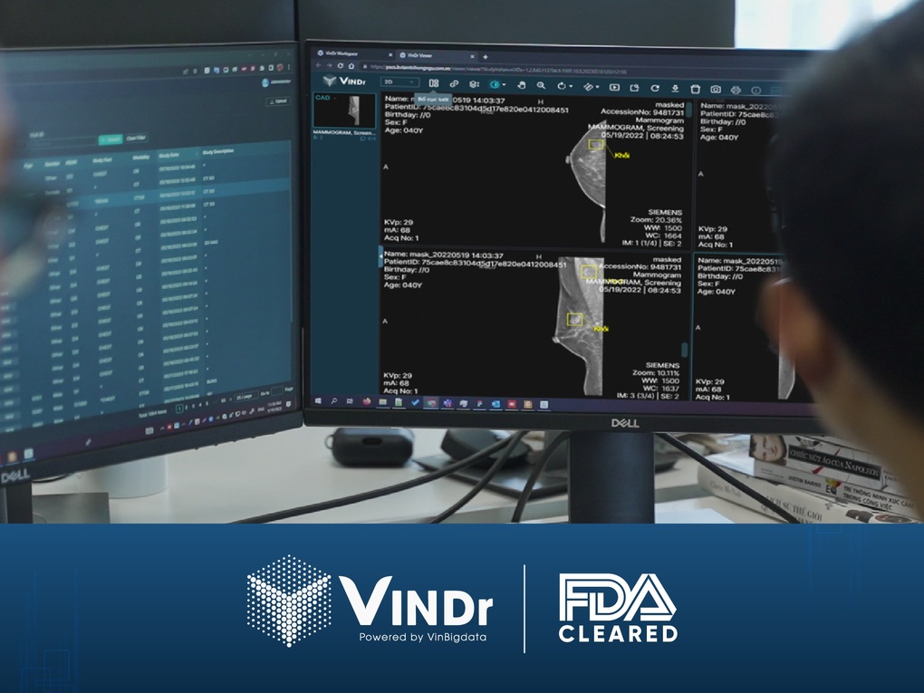 Chứng nhận FDA mở cánh cửa để VinBigdata chinh phục các thị trường hàng đầu - 3 Chứng nhận FDA mở cánh cửa để VinBigdata chinh phục các thị trường hàng đầu - 3