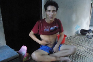 Suýt mất mạng vì ruột thừa do bác sĩ chẩn đoán... nhầm