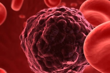 Góc nhìn mới về nguyên nhân gây ra căn bệnh ung thư quái ác