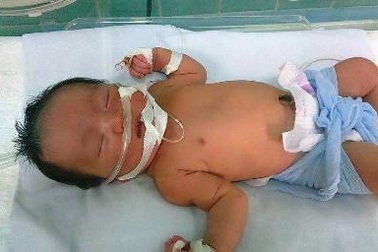 Quảng Bình: Sản phụ đẻ rơi bé gái nặng 2,5kg ngay trên taxi