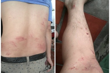 Công an An Giang vào cuộc vụ người xuất hiện trong phóng sự điều tra bị đánh