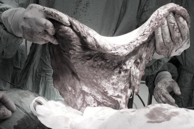 Mang "mai rùa" nặng 5kg nằm trên lưng