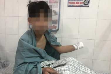 Nam sinh 15 tuổi phải cắt cụt tay do nghịch pháo tự chế