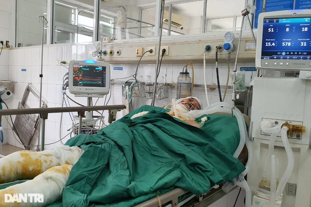 Xin cứu giúp chàng trai nghèo hiếu thảo bị phóng điện như ngọn đuốc sống - 6 Xin cứu giúp chàng trai nghèo hiếu thảo bị phóng điện như ngọn đuốc sống - 6