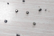 Bé trai 4 tuổi bị thủng ruột vì nuốt 10 cục pin và nam châm