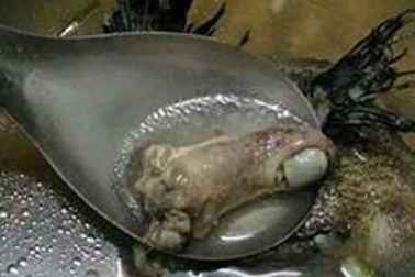 Đứng tim khi thấy “ngón tay người” trong bát canh cá