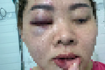 Xét kỷ luật thầy giáo đánh vợ nhập viện chỉ vì… ức chế