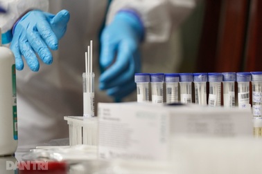 Công nhân bị trừ 4,5 triệu tiền xét nghiệm: Vì sao chọn nơi giá "cắt cổ"?