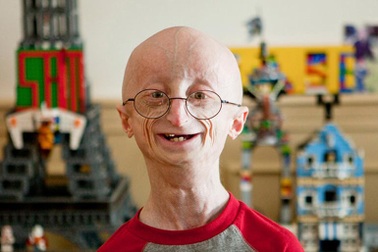 Những đứa trẻ kỳ lạ nhưng có thật