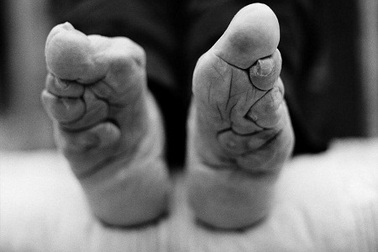 Những phụ nữ bó chân cuối cùng ở Trung Quốc