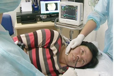 Nội soi tiêu hóa bằng đường mũi, phát hiện ung thư sớm