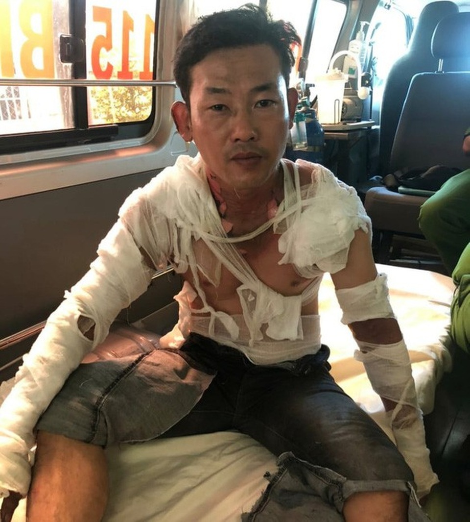 Kẻ mang xăng xông vào cướp ngân hàng rồi châm lửa tự tử khi bị truy bắt khai gì? - 1 Kẻ mang xăng xông vào cướp ngân hàng rồi châm lửa tự tử khi bị truy bắt khai gì? - 1