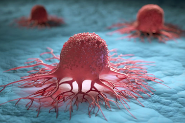 3 loại ung thư có hiệu quả điều trị cao nhất