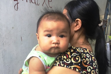 Con thơ khát sữa vì mẹ bị điện giật có nguy cơ chết não