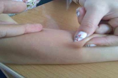 Nhiễm ký sinh trùng nguy hiểm do hay…ăn phở bò tái