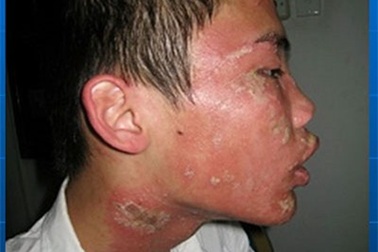 Kiến ba khoang tấn công, người Sài Gòn “mất ăn mất ngủ”