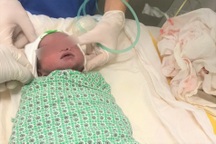 Bé trai sống sót kỳ diệu khi thai song sinh còn lại bị sảy trước đó 2 tháng