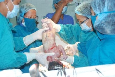 Hai mẹ con tử vong sau sinh mổ là do tác dụng phụ của thuốc?