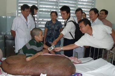 Cuối tháng 11 sẽ phẫu thuật cho người mang khối bướu khổng lồ