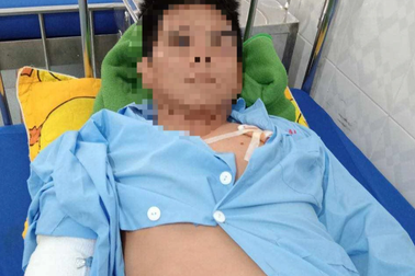 Chó becgie nặng 35kg điên cuồng lao vào cắn chủ