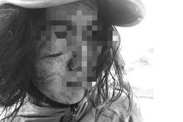 Cô gái bị rạch nát mặt trên đường đi làm đơn ly hôn