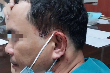 Nhắc người nhà bệnh nhân ghi đúng tuổi, nam điều dưỡng bị hành hung