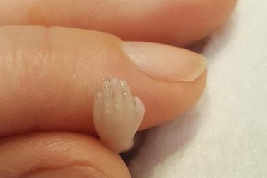 Quá tiếc thương, cha mẹ cất con sinh non 14 tuần tuổi trong tủ lạnh