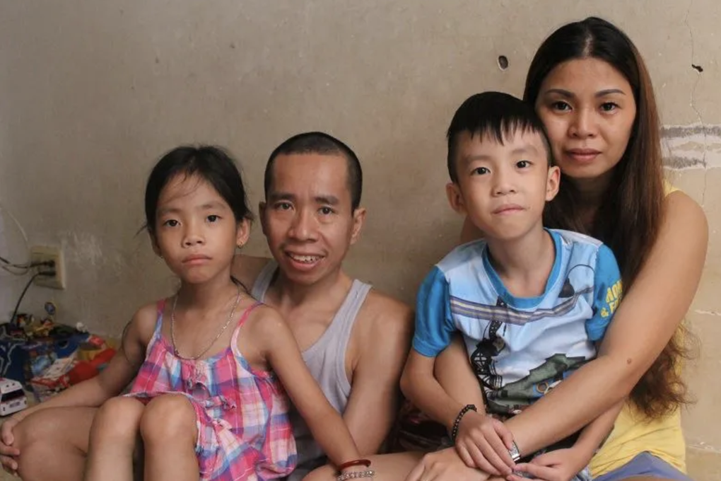 Người mổ tách song sinh Việt - Đức, bàn tay vàng ngành ngoại khoa qua đời - 2 Người mổ tách song sinh Việt - Đức, bàn tay vàng ngành ngoại khoa qua đời - 2