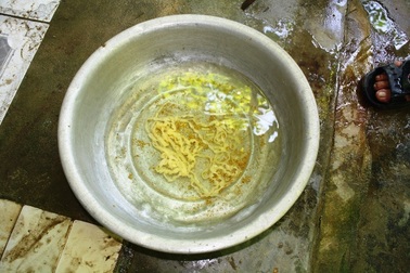  “Chung sống” với sán xơ mít dài 12m trong ruột suốt 4 năm 