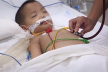 Biến chứng bệnh tay chân miệng: Bé trai suy hô hấp, tổn thương não nặng