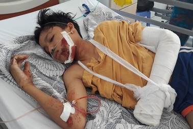 Vụ xe biển xanh gây tai nạn chết người: Thêm một nạn nhân nguy kịch