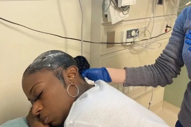 Nhập viện vì "dùng tạm" keo "con voi" khi hết keo xịt tóc