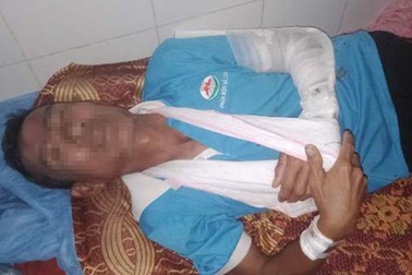 Vừa ra tù lại tiếp tục tìm nạn nhân đánh gãy tay