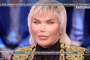 "Sao" nghiện thẩm mỹ Rodrigo Alves thừa nhận mũi "sụp xuống" sau ca phẫu thuật thứ 11