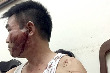 Hà Nội: Cán bộ thanh tra xây dựng đánh anh trai nhập viện