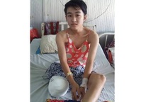 Vụ nữ sinh bị cưa chân: Tạm đình chỉ công tác của bác sĩ trực tiếp bó bột