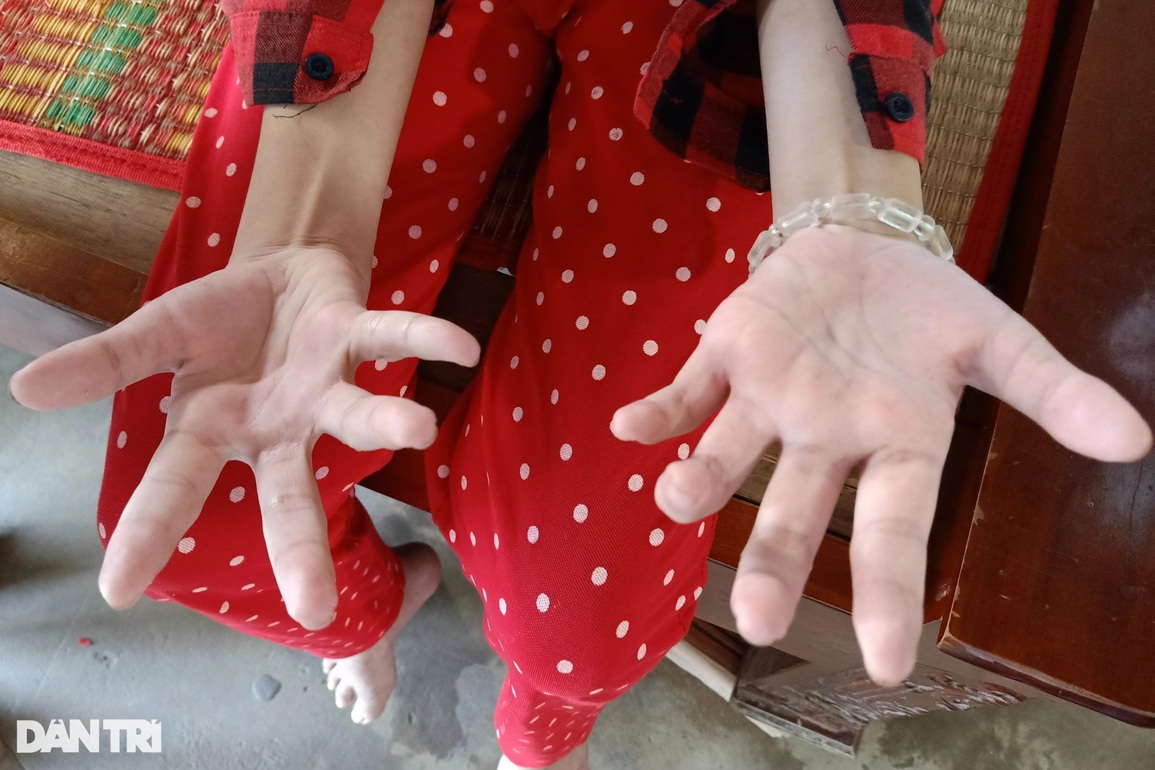 Bạn đọc giúp bé gái mắc bệnh, mồ côi mẹ, cha câm điếc hơn 100 triệu đồng - 4 Bạn đọc giúp bé gái mắc bệnh, mồ côi mẹ, cha câm điếc hơn 100 triệu đồng - 4