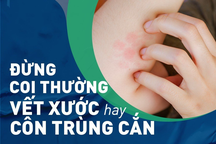 Suýt mất chân chỉ vì vết côn trùng cắn