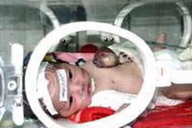 Cháu bé sơ sinh có tim nằm ngoài lồng ngực