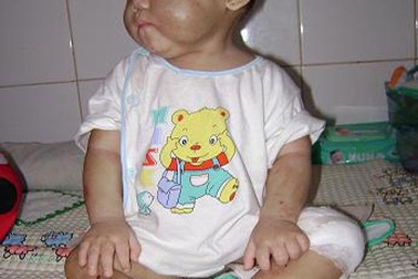 Ám ảnh khi đọc bài viết về bé Như Ý