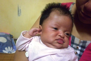 Thương hoàn cảnh cháu bé mắc căn bệnh hiếm gặp trên thế giới