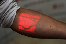 Vì sao máu màu đỏ, nhưng tĩnh mạch có màu xanh?