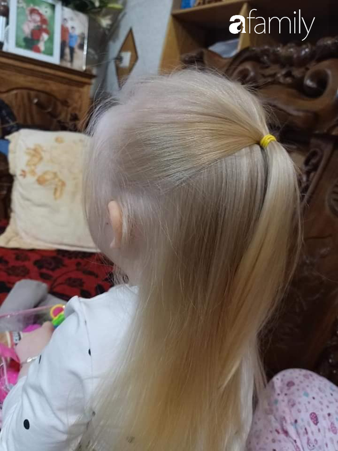 Em bé Nghệ An sinh ra tóc vàng như Tây dù bố mẹ là người Việt, càng lớn càng giống búp bê ai gặp cũng xin chụp ảnh - Ảnh 4.