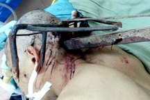 Côn đồ dùng cào sắt bổ thẳng vào đầu công an