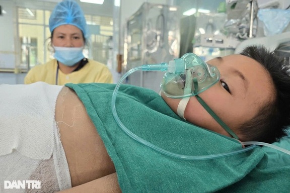 Đau nhói lòng cảnh bé 7 tuổi bị bỏng nặng và sự ân hận của người mẹ