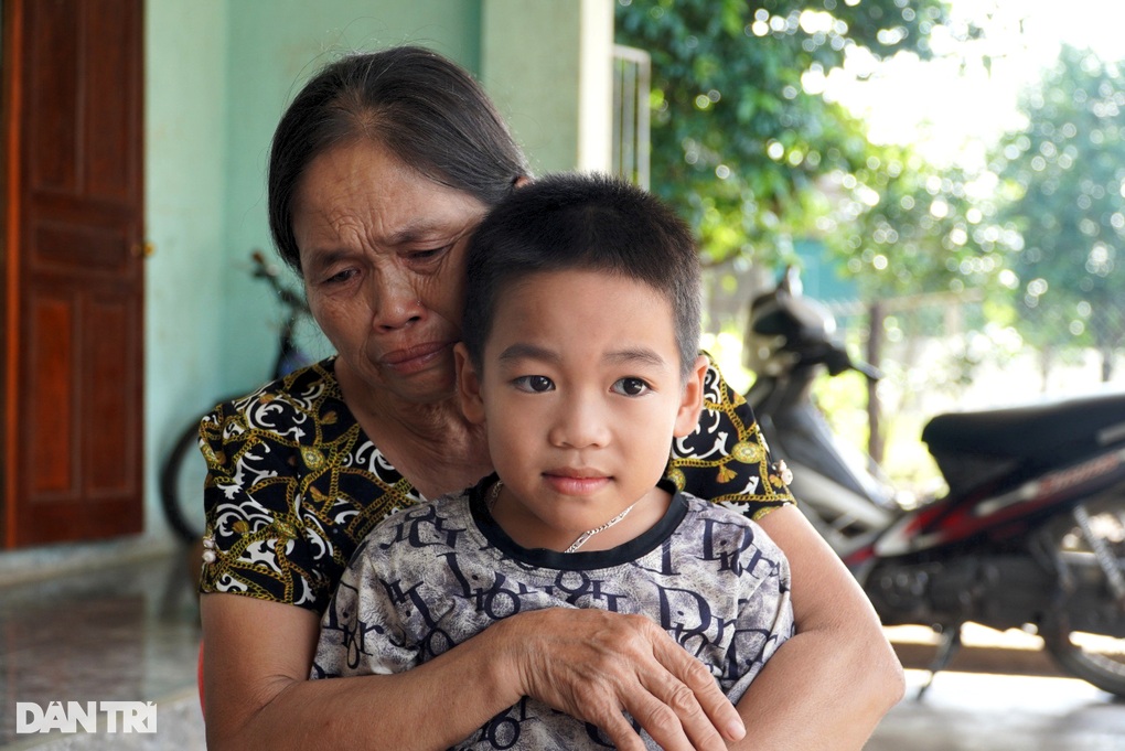 Bé trai 8 tuổi biến dạng khuôn mặt vì ung thư máu, xin mẹ về nhà chịu đau - 2 Bé trai 8 tuổi biến dạng khuôn mặt vì ung thư máu, xin mẹ về nhà chịu đau - 2