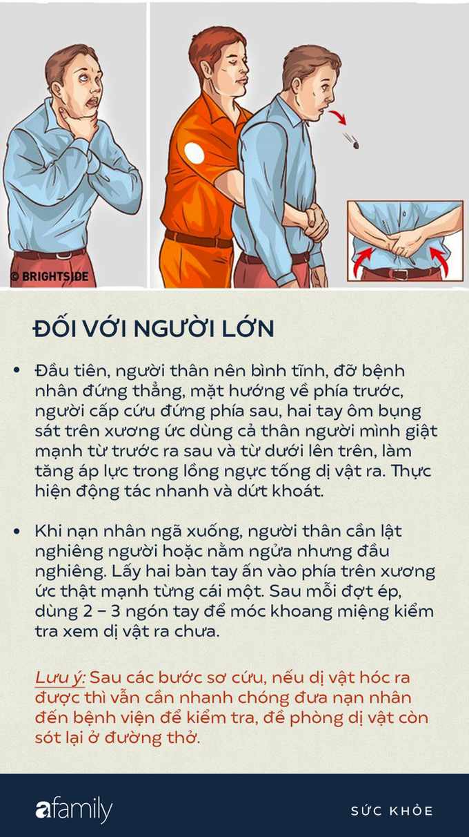 Hóc thạch - Tai nạn thường thấy dịp Tết cần sơ cứu thế nào mới đúng? - Ảnh 4.